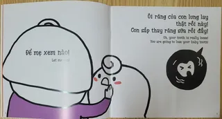 Mẹ kiểm tra răng sữa lung lay của con